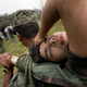 An FARC fighter injured during an army attack on her camp.